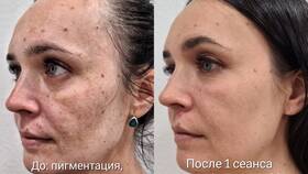 Методы удаления пятен от месячных в Фамилия